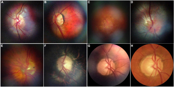 Successful Animal Trials! India's First 3D Printed Cornea "Can Be Used for Humans"