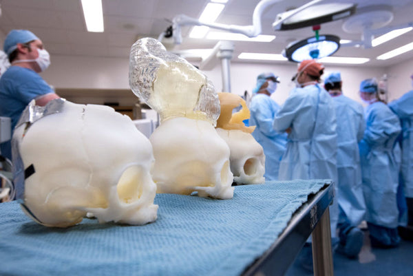 3D Printing Helps Save Newborns with Skull Defects